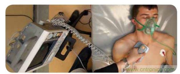 帶電極的醫院用除顫器。注意，患者身上有外部心電圖或心臟監護儀，從胸部的白色圓片(電極)和導聯(線)可看出來。