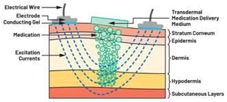 圖5.人體皮膚分層橫截面以及TMD和生物阻抗測量 考慮到生物阻抗分析的無創性,使用兩個金屬電極代表電氣傳感器,連接模擬前端(AFE)電路和患者皮膚。這個金屬與非金屬的接觸點是構成整個電路的另一個關鍵部分,連接了AFE和人體電氣模型。電荷載體(電極中的電子和人體內的離子)之間的相互作用可能對這些傳感器的性能產生重大影響,需要根據每種應用進行具體考慮。首先,金屬與離子溶液接觸的相互作用導致金屬表面附近溶液中離子濃度的局部變化。這種現象會改變電極下方區域的電荷中性,導致金屬周圍的電解質電位與溶液其余部分不同,從而在金屬和電解質主體之間產生一個電位差,即常說的“半電池電位”。其次,注入電流的直流分量會導致電極極化。 表1.各種電極類型和相應的半電池電位 金屬及反應 半電池電位(V) Al → Al3+ + 3e- Al → Al3+ + 3e- –1.706 –1.706 Ni → Ni2+ + 2e- Ni → Ni2+ + 2e- –0.230 -0.230 H2 → 2H+ + 2e- H2 → 2H+ + 2e- 0.000 (by definition) 0.000(根據定義) Ag + Cl- → AgCl + e- Ag + Cl- → AgCl + e- +0.223 +0.223 Ag → Ag+ + e- Ag → Ag+ + e- +0.799 +0.799 Au → Au+ + e- Au → Au+ + e- +1.680 +1.680 這是一種不良現象,往往導致電極性能下降。這些考量表明,電極也需要定義適當的電氣模型(參見圖6)。我們可以將干電極表示為具有三個串聯元件的電路:一個用于模擬半電池電位(EHC)的直流電源;一個用于模擬金屬和非金屬(人體)之間接觸的RC并聯電池(Rd||Cd);以及一個用于模擬電極金屬的電阻Rs。 圖5.人體皮膚分層橫截面以及TMD和生物阻抗測量 考慮到生物阻抗分析的無創性,使用兩個金屬電極代表電氣傳感器,連接模擬前端(AFE)電路和患者皮膚。這個金屬與非金屬的接觸點是構成整個電路的另一個關鍵部分,連接了AFE和人體電氣模型。電荷載體(電極中的電子和人體內的離子)之間的相互作用可能對這些傳感器的性能產生重大影響,需要根據每種應用進行具體考慮。首先,金屬與離子溶液接觸的相互作用導致金屬表面附近溶液中離子濃度的局部變化。這種現象會改變電極下方區域的電荷中性,導致金屬周圍的電解質電位與溶液其余部分不同,從而在金屬和電解質主體之間產生一個電位差,即常說的“半電池電位”。其次,注入電流的直流分量會導致電極極化。 表1.各種電極類型和相應的半電池電位 金屬及反應 半電池電位(V) Al → Al3+ + 3e- Al → Al3+ + 3e- –1.706 –1.706 Ni → Ni2+ + 2e- Ni → Ni2+ + 2e- –0.230 -0.230 H2 → 2H+ + 2e- H2 → 2H+ + 2e- 0.000 (by definition) 0.000(根據定義) Ag + Cl- → AgCl + e- Ag + Cl- → AgCl + e- +0.223 +0.223 Ag → Ag+ + e- Ag → Ag+ + e- +0.799 +0.799 Au → Au+ + e- Au → Au+ + e- +1.680 +1.680 這是一種不良現象,往往導致電極性能下降。這些考量表明,電極也需要定義適當的電氣模型(參見圖6)。我們可以將干電極表示為具有三個串聯元件的電路:一個用于模擬半電池電位(EHC)的直流電源;一個用于模擬金屬和非金屬(人體)之間接觸的RC并聯電池(Rd||Cd);以及一個用于模擬電極金屬的電阻Rs。